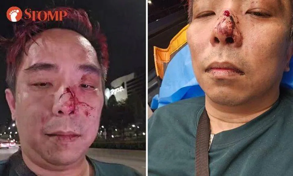 My passengers beat me up when I tried to stop them fighting: Grab driver