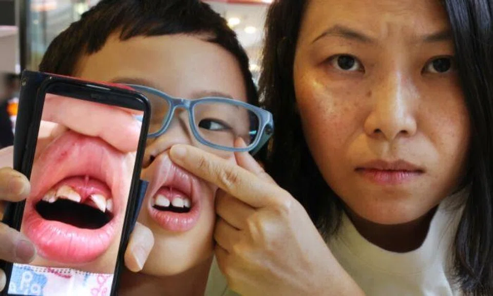 The mother brought her son to a dental clinic and was told that the majority of her son's permanent front teeth were broken. 