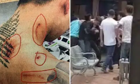 Fight between staff of two Toa Payoh shops: Employee was beaten with metal rack, 38-year-old man arrested