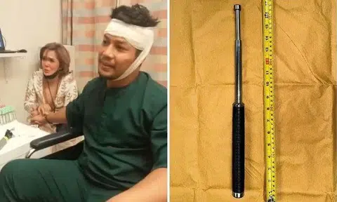 Malaysian actor Ahmad Kamal Ahmad Adli was rushed to Changi General Hospital and received four stitches after the attack. PHOTOS: ROSLAN SHAH, SINGAPORE POLICE FORCE