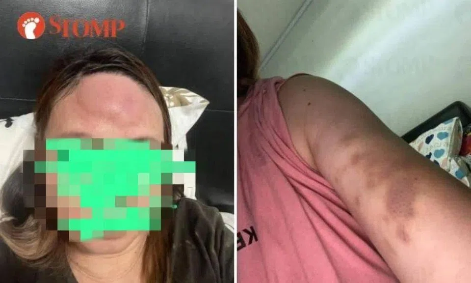 Maid discovers employer's affair, he allegedly smashes her head against wall