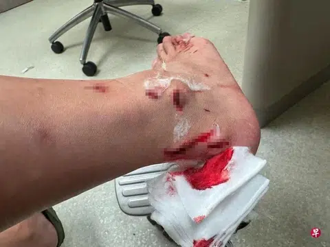 The pregnant woman was injured when the glass panel shattered.