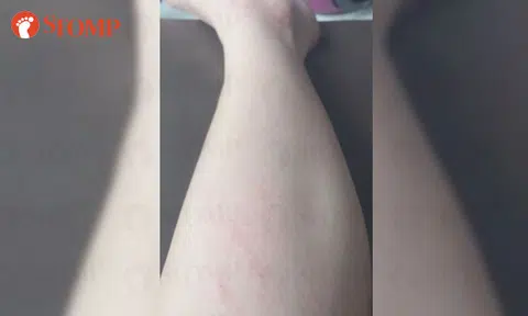Man knocks woman over while running for bus at Buangkok Green, doesn't stop to apologise or help