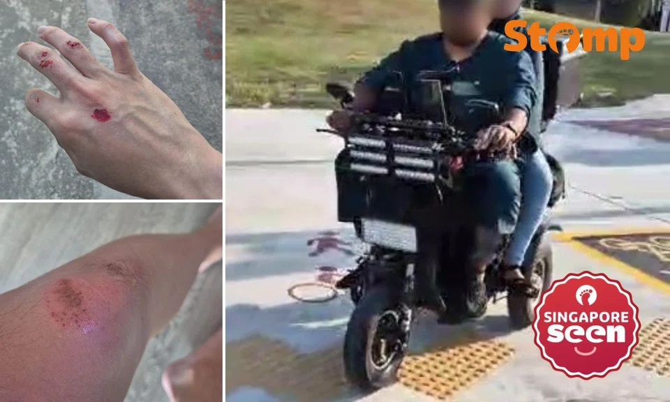 Cyclist hurt after PMD allegedly rear-ended him in Kaki Bukit