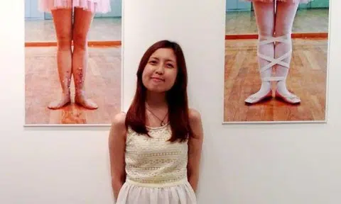 Don't be fooled by her appearance -- this 35-year=old woman suffers from a painful disease