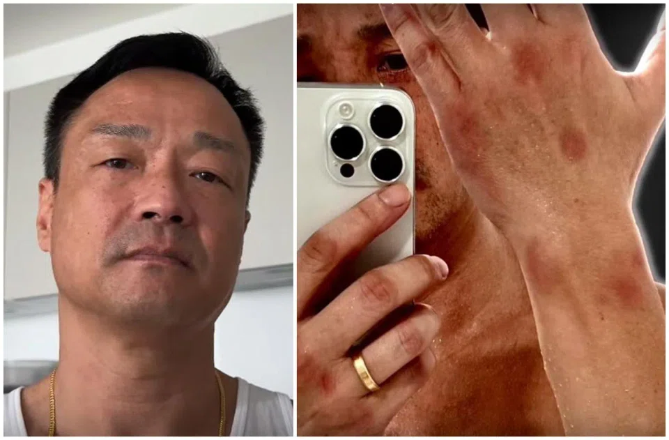 Wong He said his kidney failure might be linked to two suspected sexual assaults that took place in Taiwan in 2024.