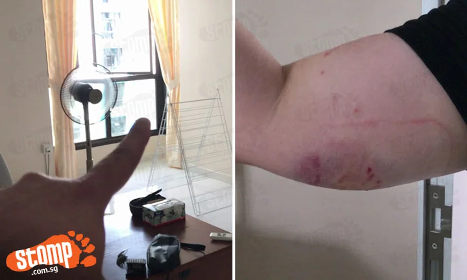 Left: Window where the monkey came into the Stomper Zenn's house. Right: Injuries sustained by Stomper Zenn