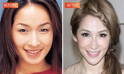 Did Taiwan’s Elva Hsiao have plastic surgery? Check out her drastic transformation