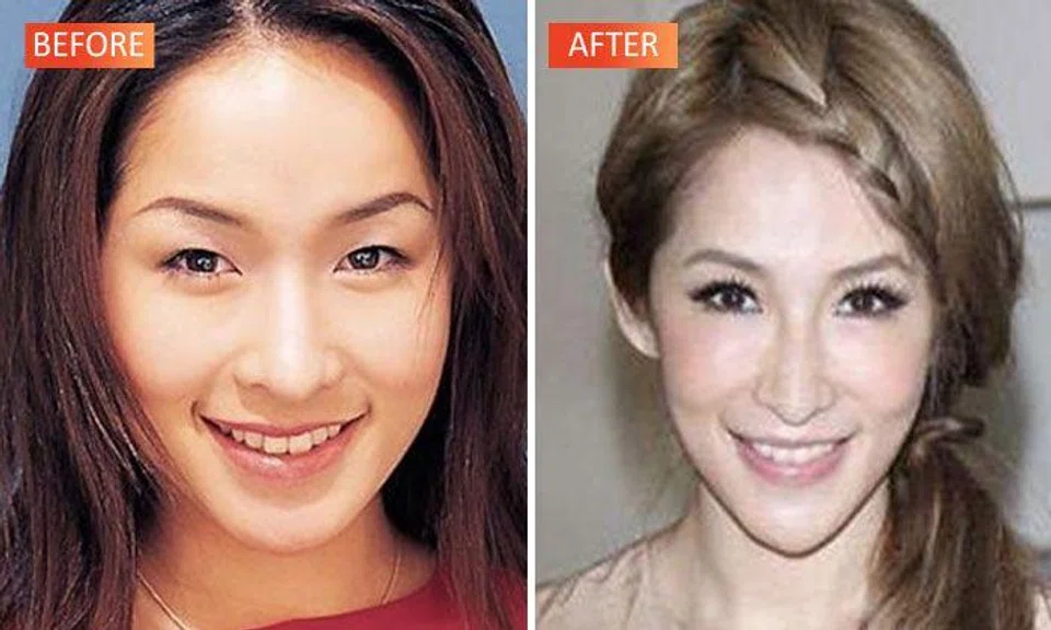 Did Taiwan’s Elva Hsiao have plastic surgery? Check out her drastic transformation