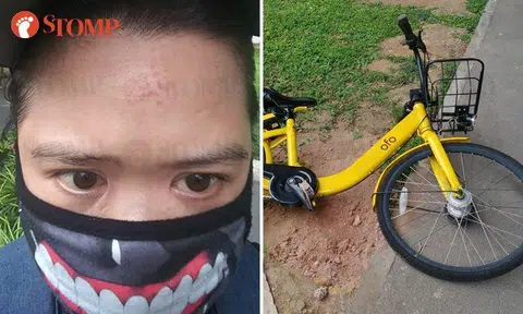 Cyclist injured after crashing into ofo bicycle left lying in the middle of Woodlands pathway