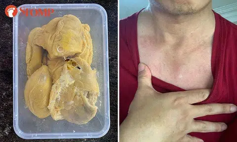 Durian vendor allegedly strangled, beat up employee over 'unsellable' Mao Shan Wang durians