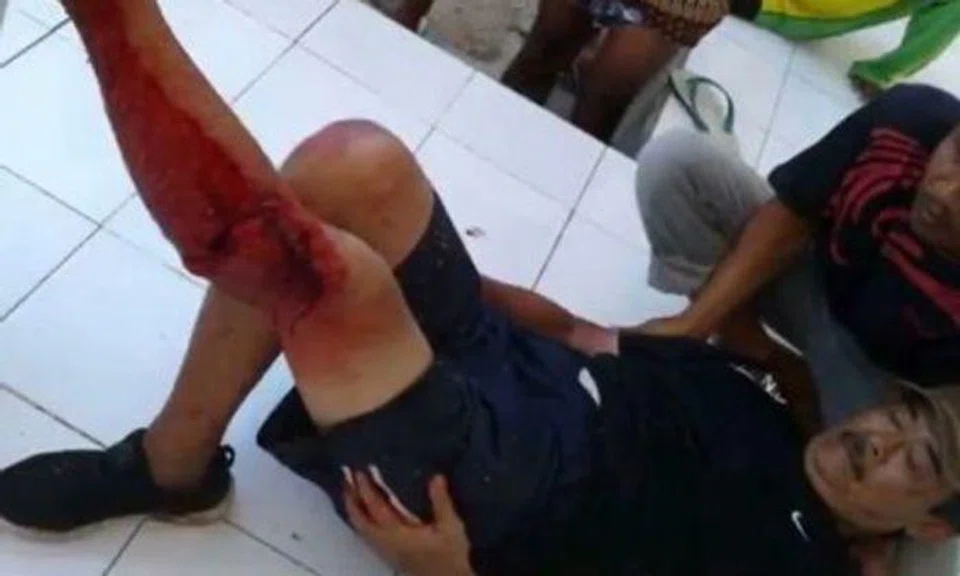 S'pore tourist suffers brutal injuries from Komodo dragon -- after ignoring warnings