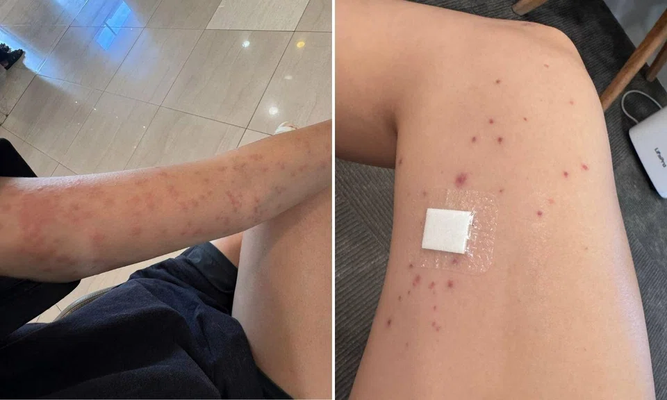 spa rash Kallang hospital