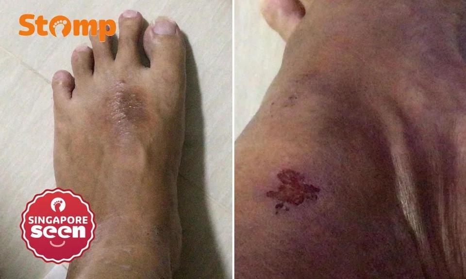 man's foot injured after kids on joyride run over it at christmas event