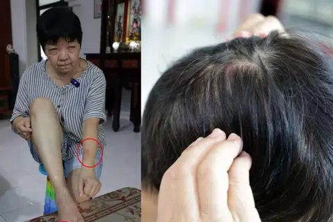 Madam Zhuo Jinfeng claims she was injured in her fight with her younger brother.