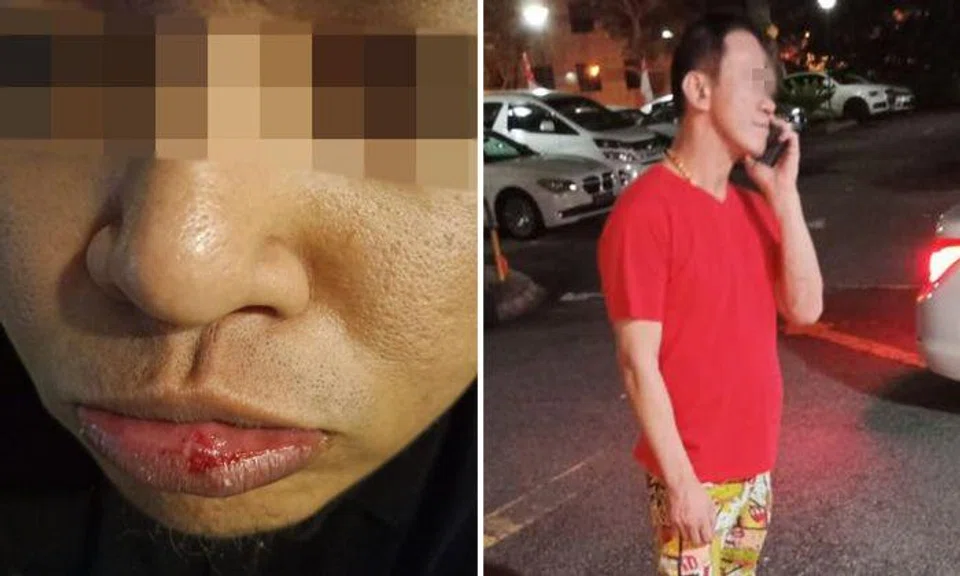 Valet driver Fairuz (left) was punched by a customer (right) along Oxley Road on Aug 12. Photos: Drive Home Service Singapore / Facebook
