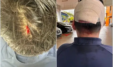 12-year-old boy allegedly hit classmate's head with bottle