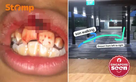 Outram Sec student left with broken teeth after alleged assault by classmate, principal says disciplinary action under way