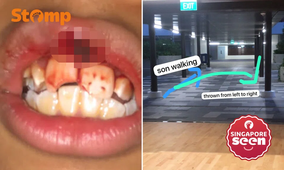 Outram Sec student left with broken teeth after alleged assault by classmate, principal says disciplinary action under way