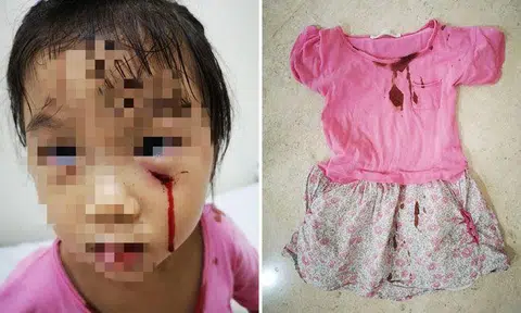 The girl had stopped outside a house to look at a pet peacock when it reportedly charged out and attacked her. PHOTOS: KRIS CHAN/FACEBOOK
