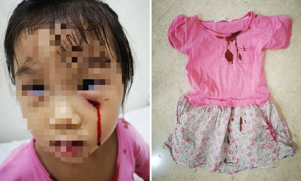 The girl had stopped outside a house to look at a pet peacock when it reportedly charged out and attacked her. PHOTOS: KRIS CHAN/FACEBOOK