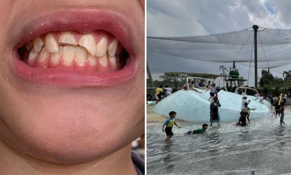 Ms Wynn Chan had related in a Facebook post on Monday about how her friend’s son had injured himself at the playground when they visited the park.