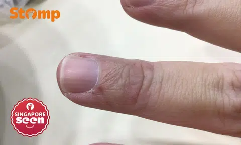 Woman opens car door in Queenstown, hits pedestrian and injures his finger