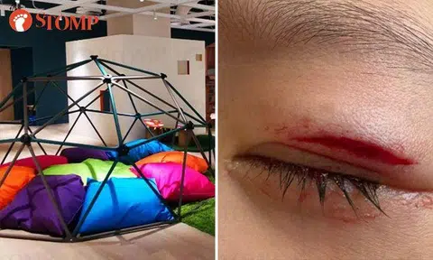Girl suffers cut above her eye while playing at The Artground One Holland Village