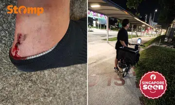 Stomper’s foot oozes blood after allegedly being hit by PMD in Yishun