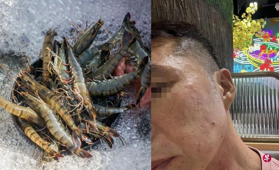 Mr Chen, who said he is allergic to shrimp but can eat tiger prawns, broke out in rashes and experienced itching on his body and face after consuming shrimp at a buffet.