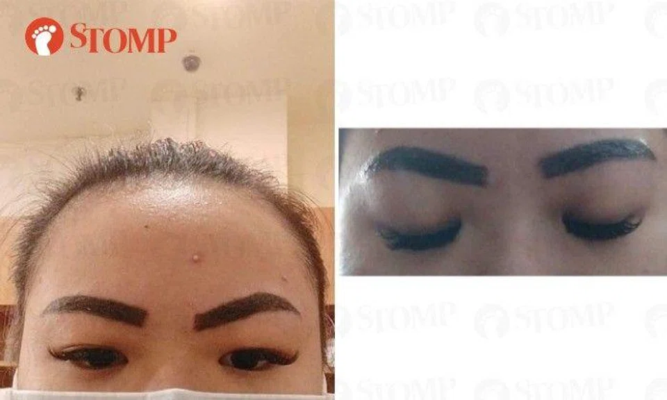 Woman's eyebrow treatment goes wrong: 'I will look like this for years'