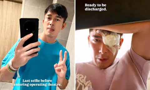 Actor Elvin Ng undergoes emergency retinal surgery after noting dark circular shadow in eye