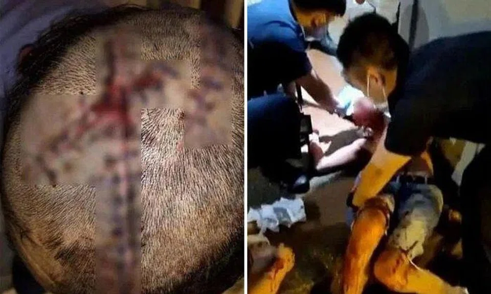 Group of strangers attacked man in Clarke Quay after 1 of them 'felt that victim had stared at him'