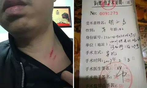 Chinese father of 4 says he was assaulted, forced to have vasectomy for breaching one-child policy
