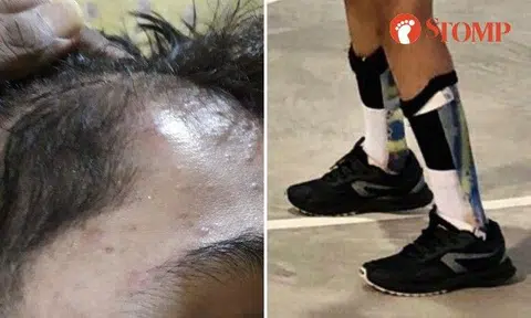 Dad 'very scared' for son with myelitis to go to school after classmate allegedly assaulted him twice