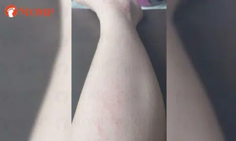 Man knocks woman over while running for bus at Buangkok Green, doesn't stop to apologise or help