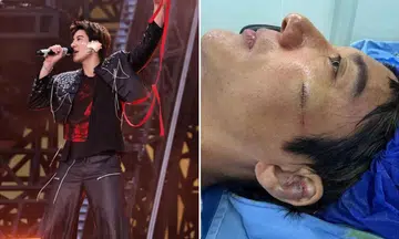Wang Leehom needed 39 stitches to his face and ear after a fall at his concert in Chengdu on July 4.