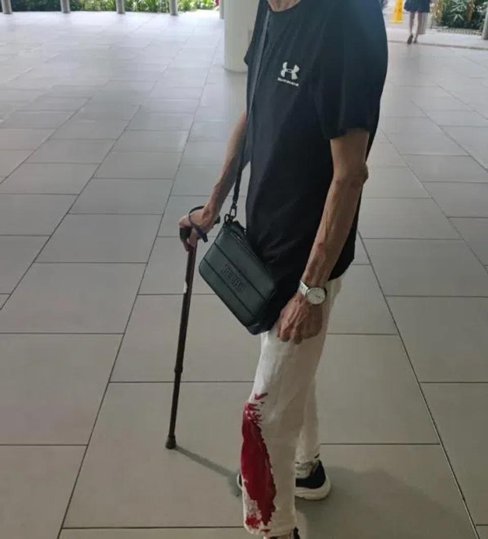 Foo's uncle suffered a nasty gash, which can be seen through his white pants.