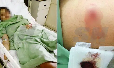 Malaysian student allegedly kidnapped, stabbed 5 times by policeman ex-BF -- and force-fed fabric softener 