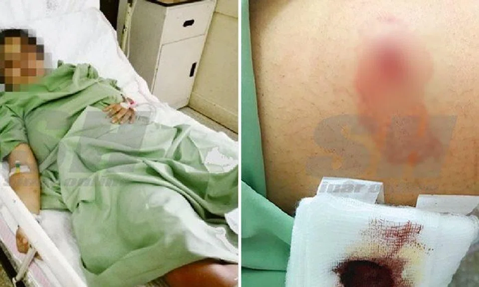 Malaysian student allegedly kidnapped, stabbed 5 times by policeman ex-BF -- and force-fed fabric softener 