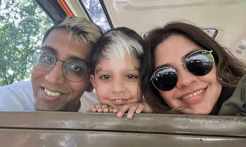 Mum stares back at strangers who stare at boy's rare condition, dad dyes hair to match son's