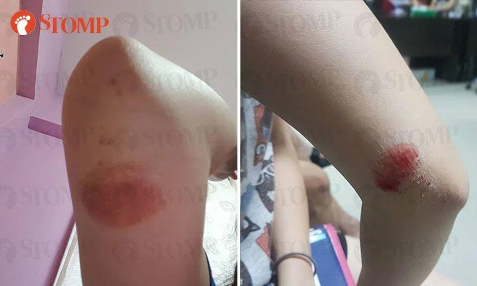 Injured e-scooter rider appealing for witnesses to accident at Admiralty MRT Station zebra crossing