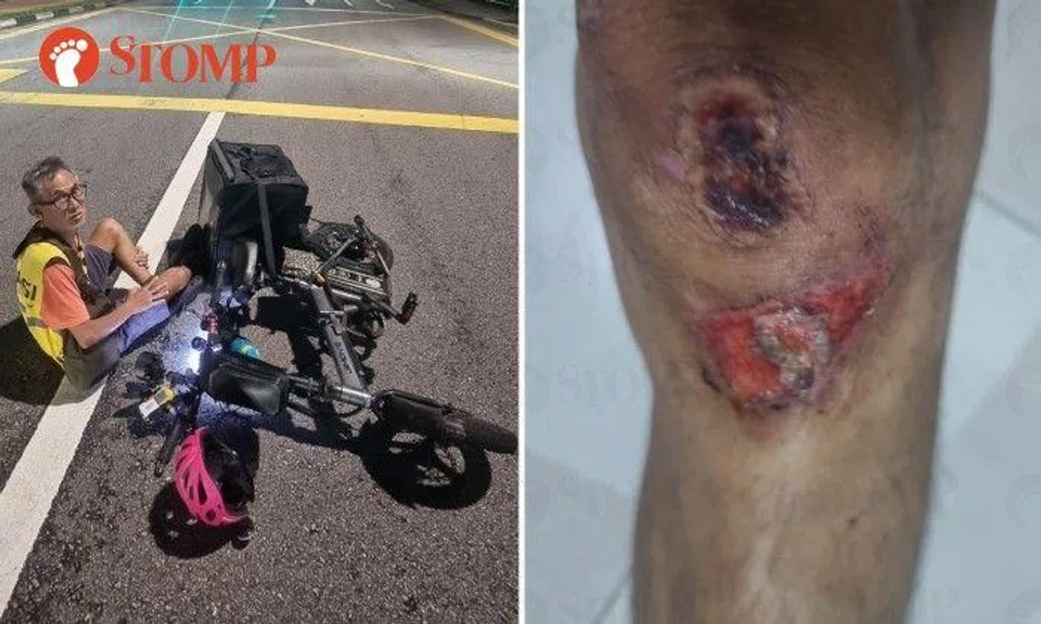 The Stomper had injuries on his left knee and both his arms and hands.