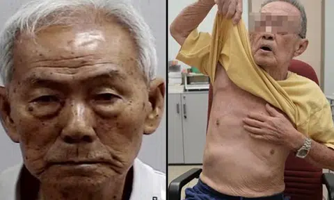 89-year-old man slashes and splashes boiling water at roommate -- for switching off lights while he was making milo