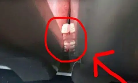 Did anyone lose a set of fake teeth? Denture was caught in between train doors 