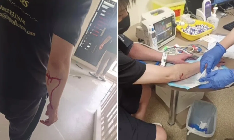 Deb collector getting treatment for injury