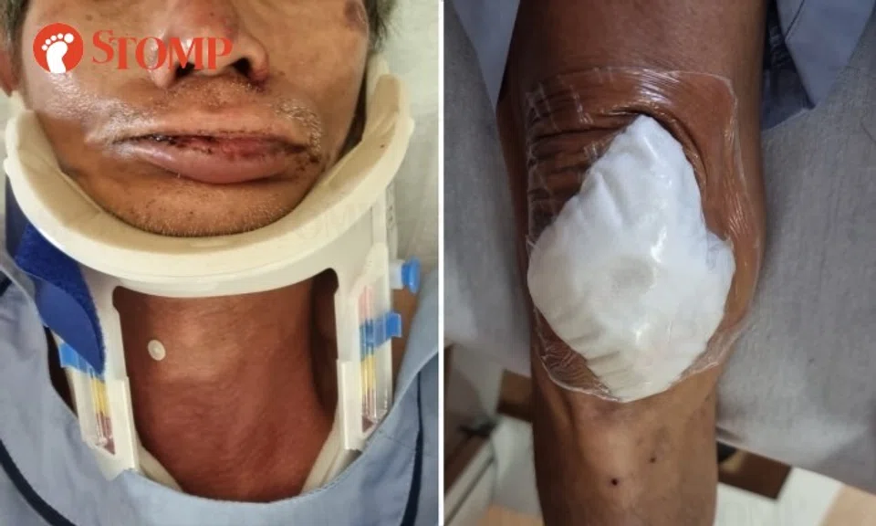 He suffered a spinal cord injury in the neck as well as a knee injury and was hospitalised until Sept 22.