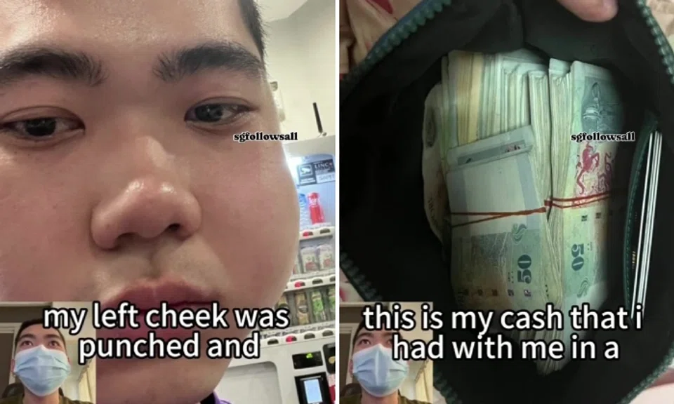 The teen has shared a video online where he recounted what happened. He said he was punched on the left cheek.