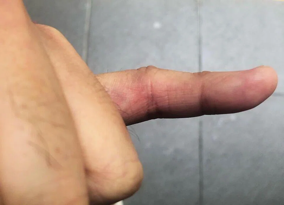 Man gets finger burnt arguing with smoker at People's Park Food Centre