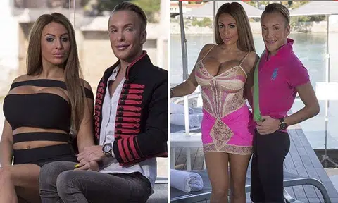 Couple spend $300,000 on surgery to look like their idols Barbie and Ken